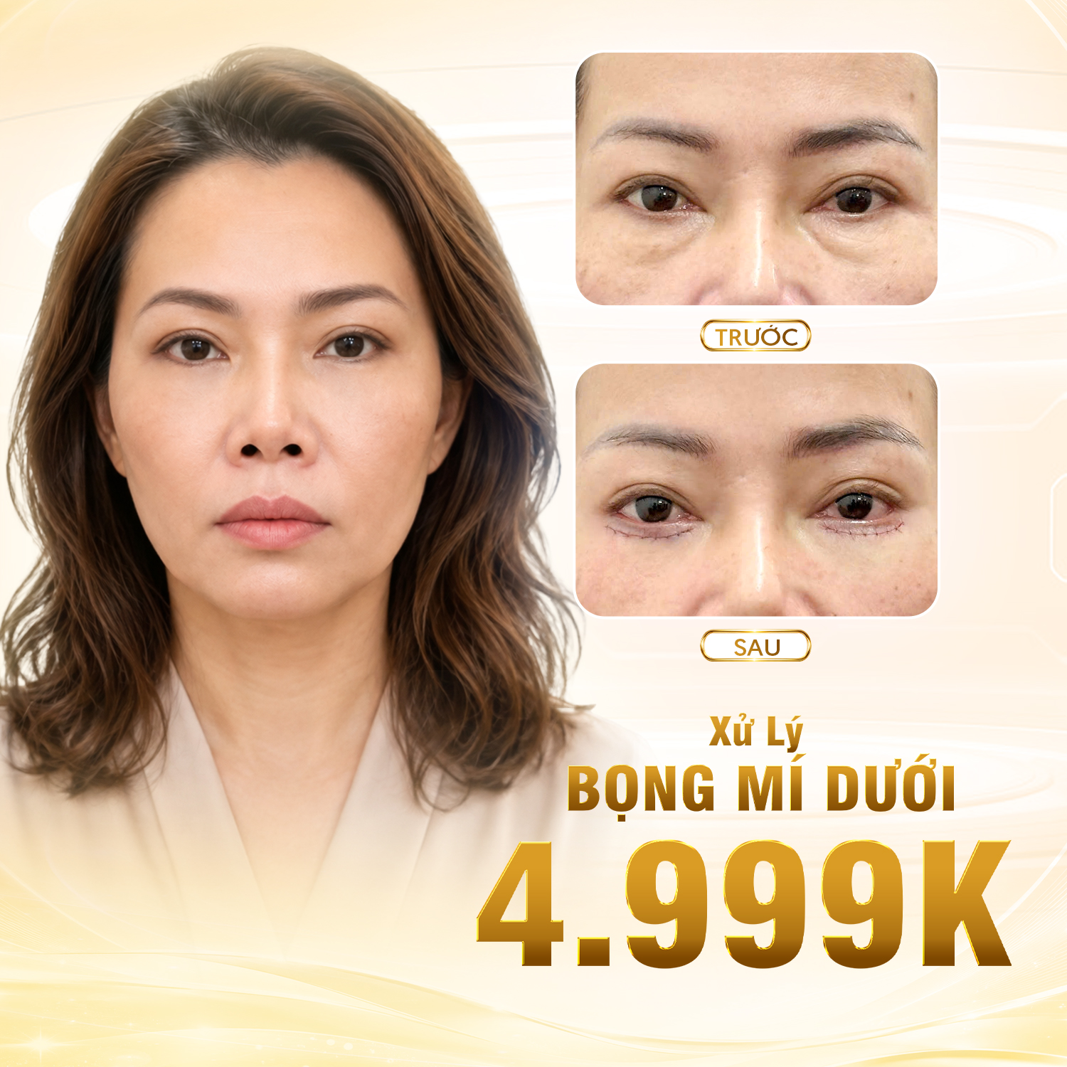 XỬ LÝ BỌNG MÍ DƯỚI