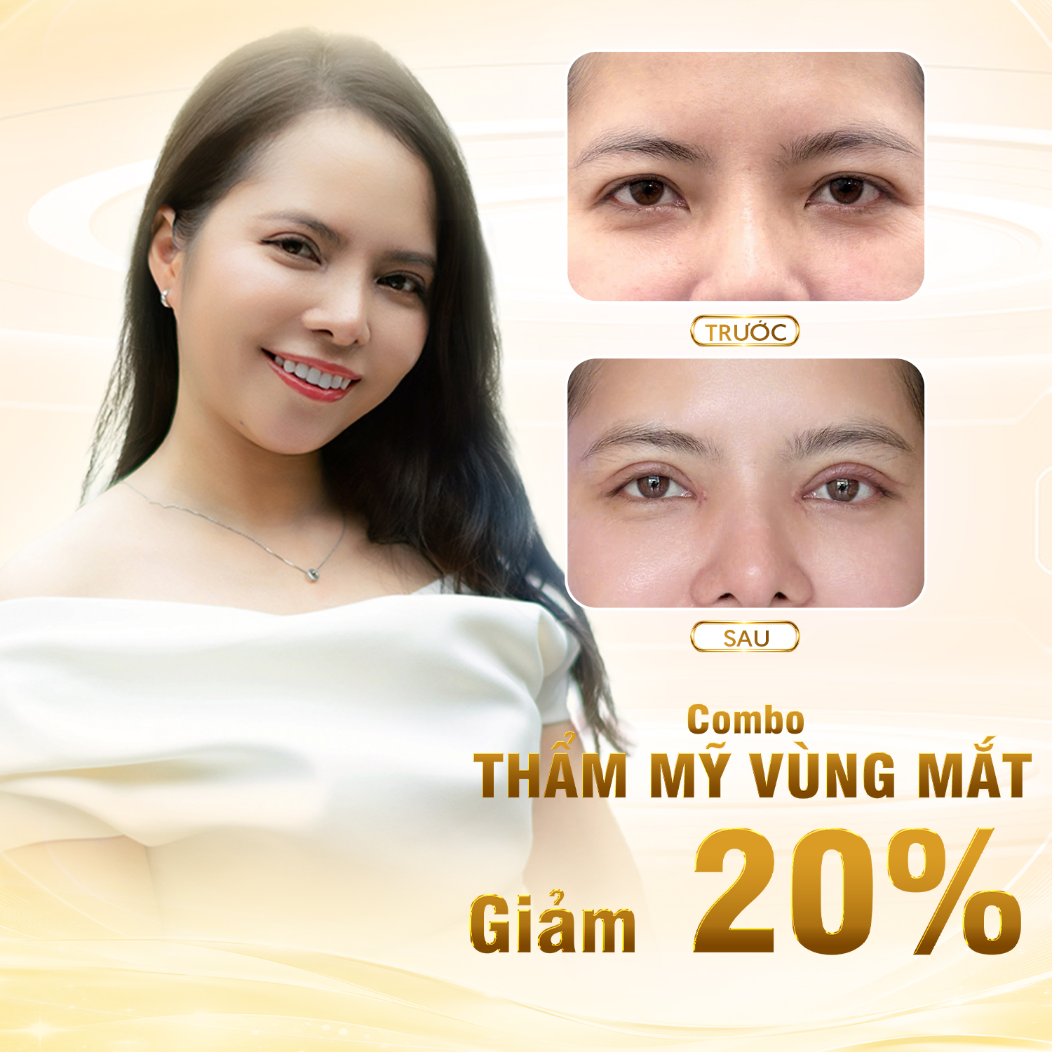 COMBO THẨM MỸ VÙNG MẮT
